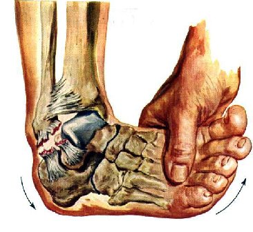 Instabilite De Cheville Dr Julien Batard